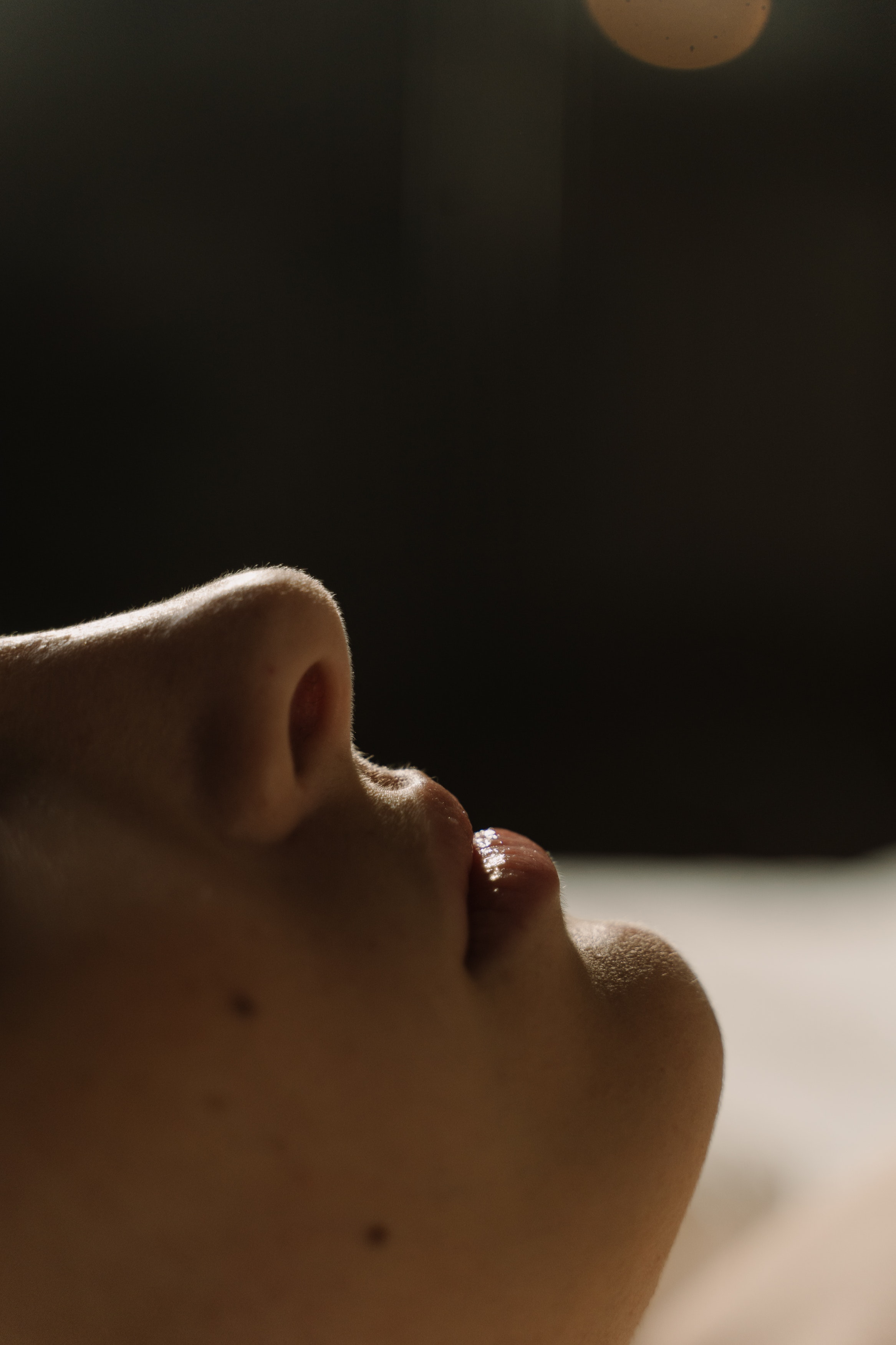 rhinoplastie chirurgicale