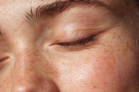 Blépharoplastie chirurgie paupières supérieures inférieures regard rajeuni naturel | Dr Dlimi | Lyon